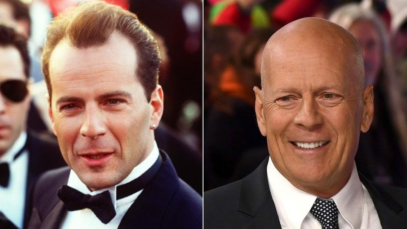 Bruce Willis im Smoking links mit Haaren, rechts kahl