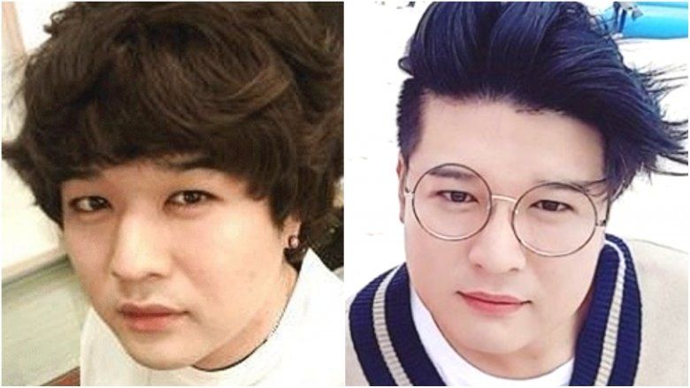 Shindong von Super Junior – Fotos vor und nach Schönheitsoperationen